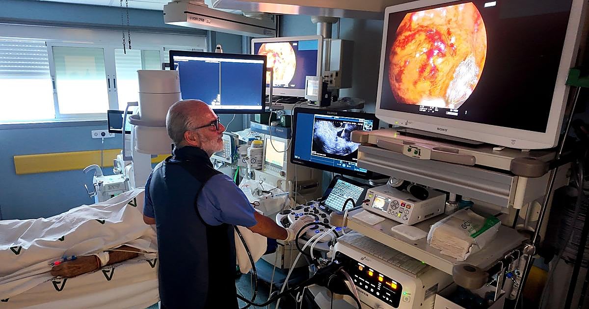 El Hospital Virgen Macarena renueva su Unidad de Endoscopia con tecnología avanzada de imagen diagnóstica