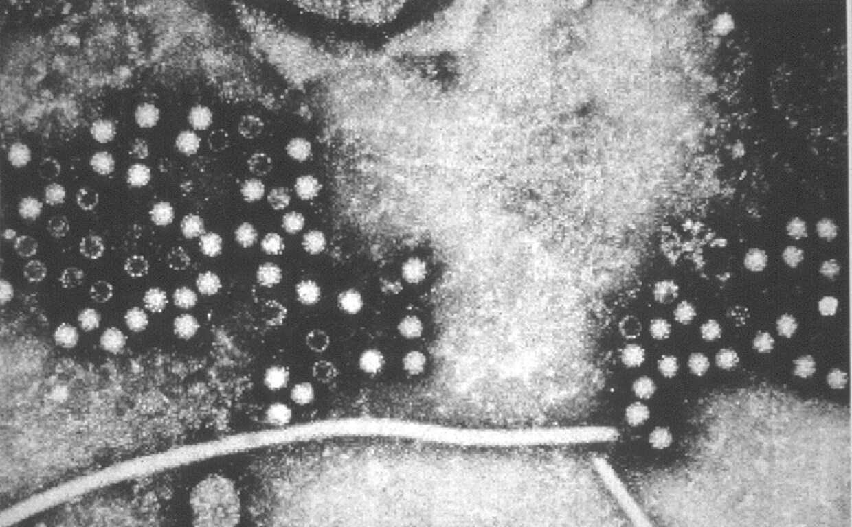 Imagen de microscopia del virus de la hepatitis
