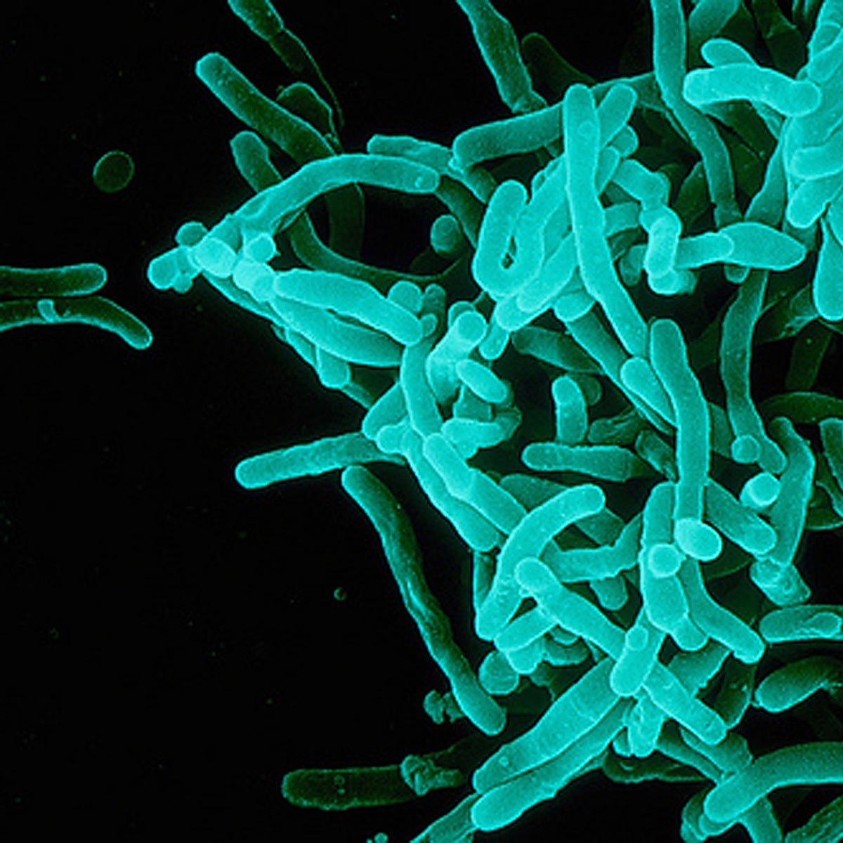 Europa alerta del incremento de casos de difteria entre inmigrantes