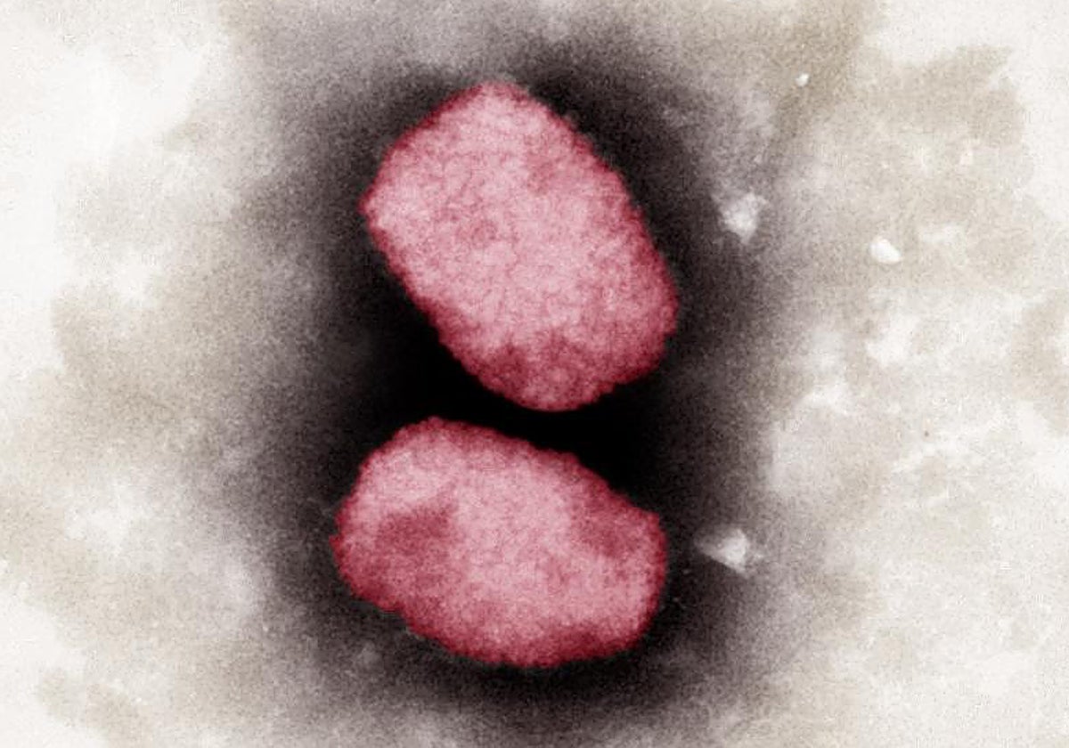Imagen al microscopio del patógeno que causa 'mpox'
