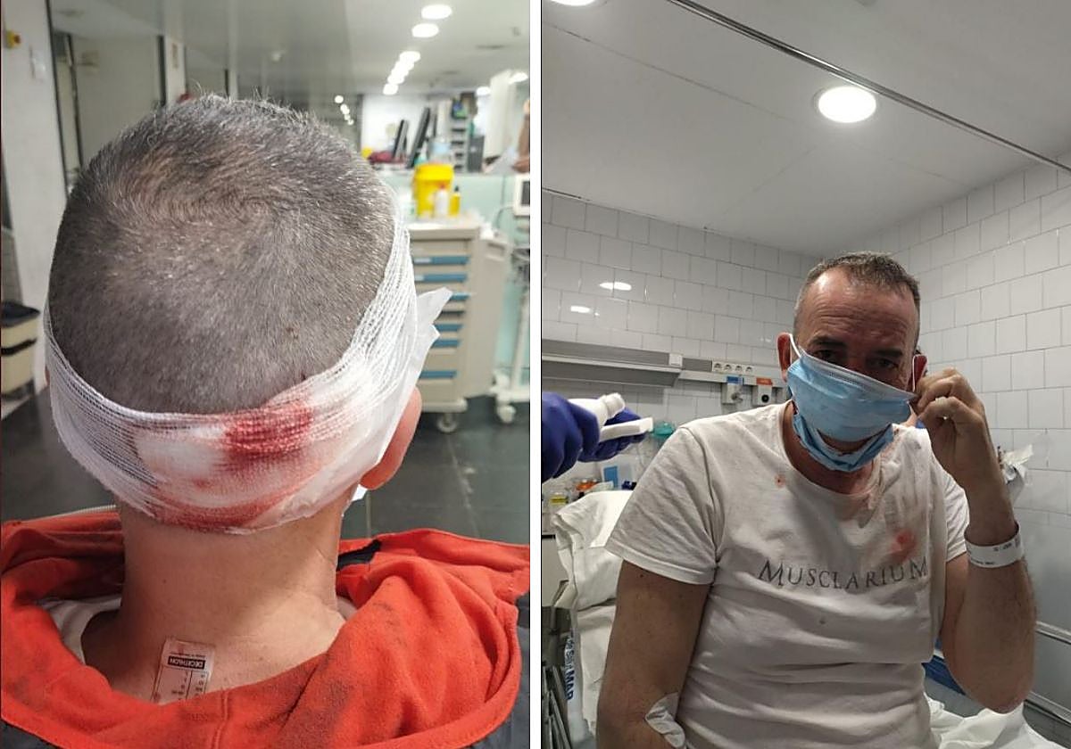 José Luis, tras ser atropellado por un patinete