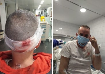 17 grapas, un esguince, un desgarro muscular y pérdida de conocimiento por un atropello de patinete: «Si pilla a un niño lo mata»