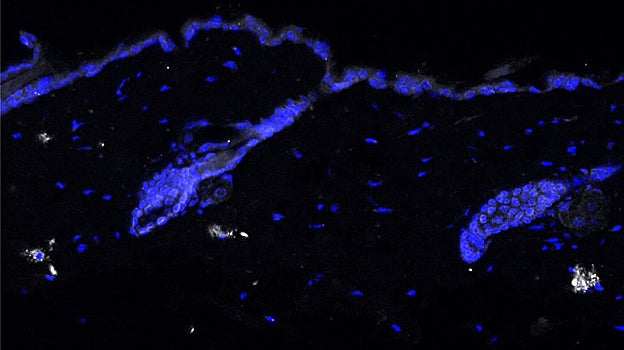 Tinción de inmunofluorescencia de IL-17 (en blanco) en piel de ratón envejecido