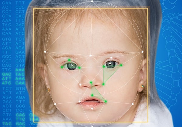 Así es la tecnología que diagnostica enfermedades genéticas a partir de una foto