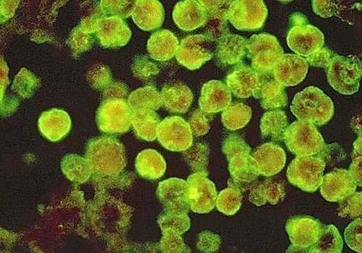 Ameba comecerbros en una imagen de archivo.