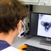 Barcelona declara un brote de viruela del mono por seis casos los meses de julio y agosto