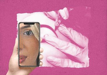 Pasar por quirófano para parecerse a un filtro de Instagram