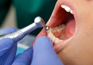 Los dentistas valoran positivamente el plan de Sanidad para salud bucodental, pero lo ven «insuficiente»