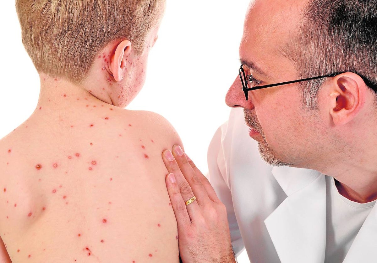 Médico mirando a un niño con sarampión