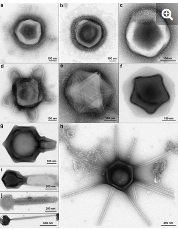 Morfotipos de partículas gigantes parecidas a virus con características estructurales únicas del suelo del bosque de Harvard. a) Morfotipo «tipo Mimi». b) Morfotipo «Supernova». c) Morfotipo «Corte de pelo». d) Morfotipo «Tortuga». e) Morfotipo «Fontanero». f) Morfotipo «estrella de Navidad». g) Morfotipo «Flacón». h) Morfotipo «Gorgona». i) - k) VLP grandes con estructuras de col