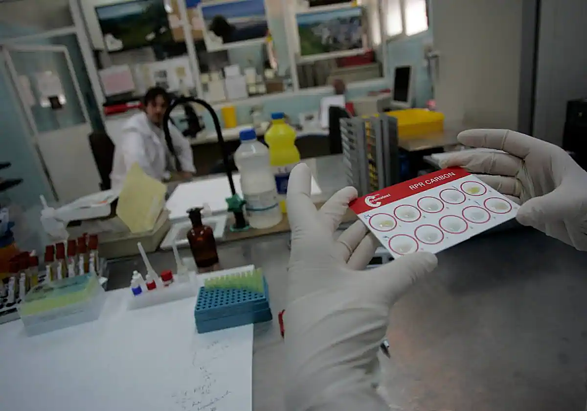 Laboratorio de centro de diagnóstico de infecciones de transmisión sexual