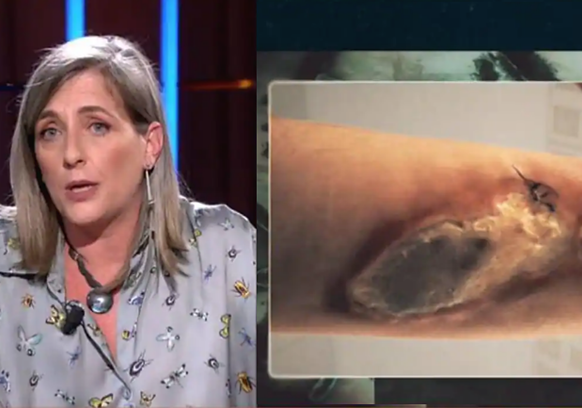 Patricia Casas en el programa Horizonte explicando su enfermedad.