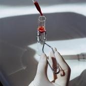 Guerra de patentes en los tribunales para llevar a las farmacias un genérico de la alternativa al sintrom