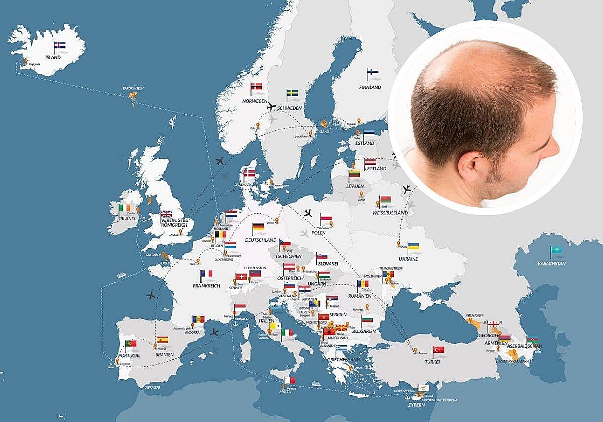 España encabeza el ranking mundial de países calvos: esta es la lista completa