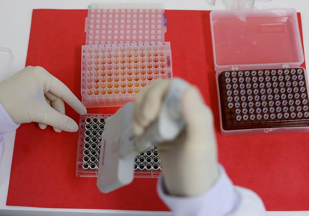 Pruebas de laboratorio con el test Elisa para detectar anticuerpos del virus de la gripe aviar