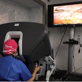Primer autotrasplante de útero en España para preservar la fertilidad tras un cáncer