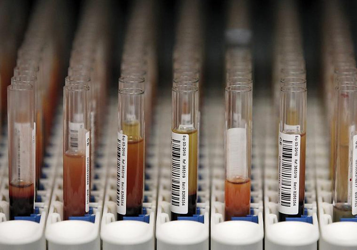 Muestras de sangre para test genéticos