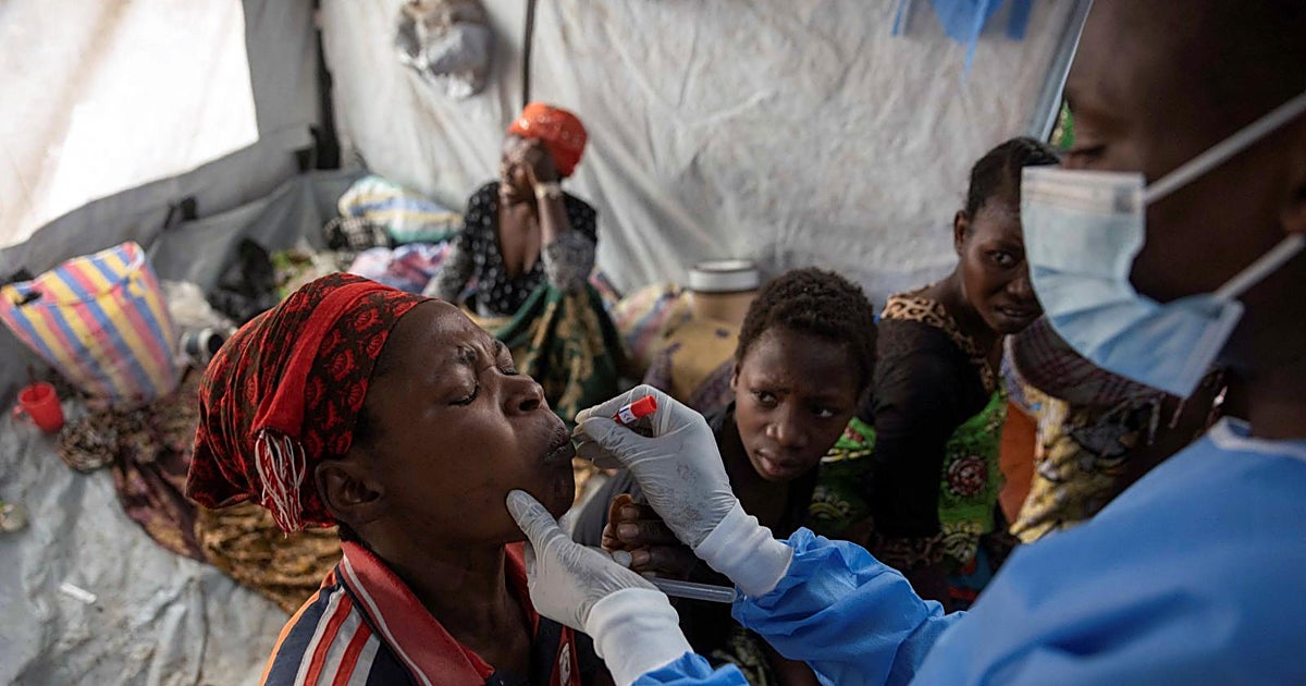 Qué se sabe de la enfermedad «X», la misteriosa infección que investiga la OMS en la República Democrática del Congo