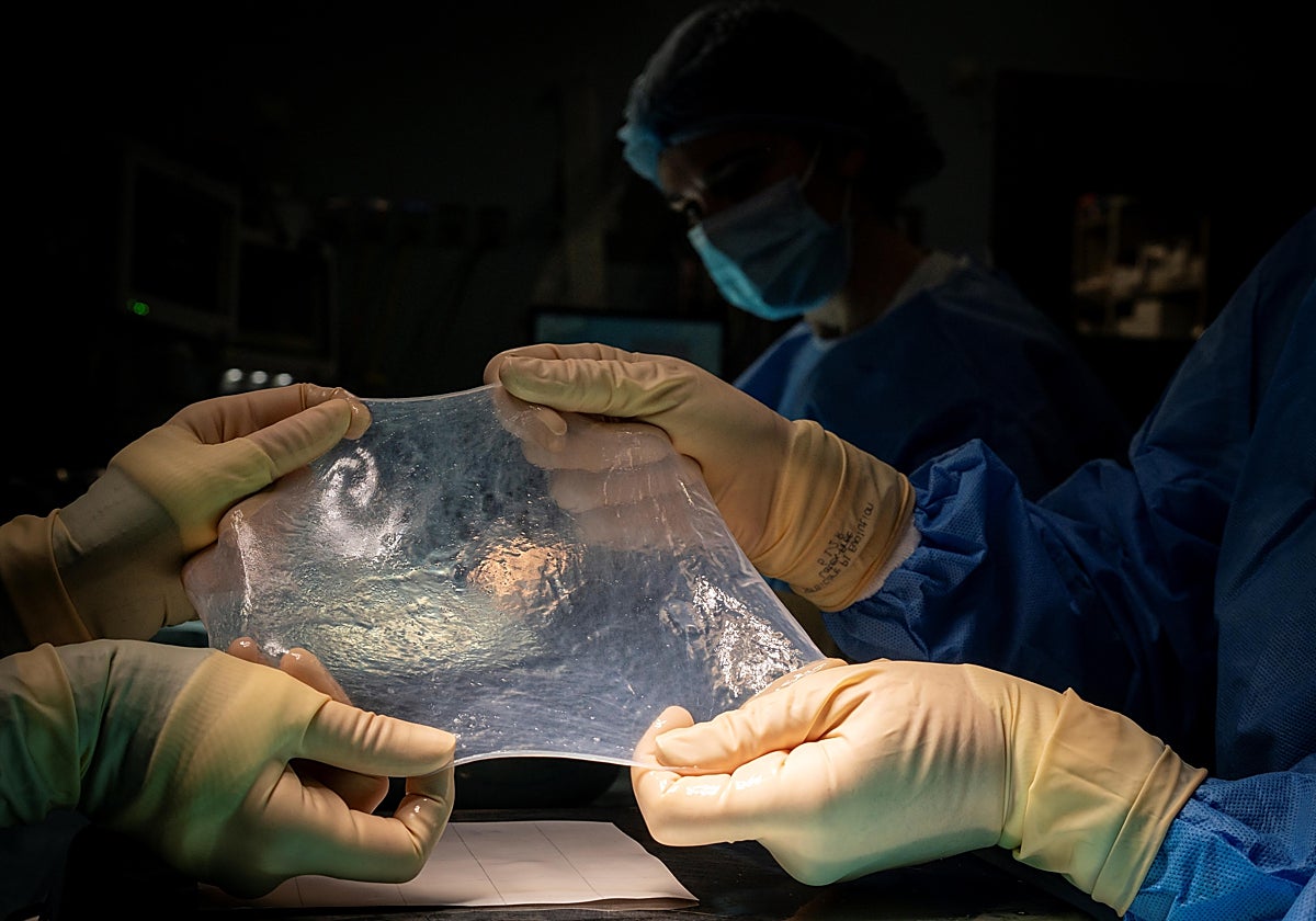 Médicos del Hospital Universitario de Getafe (Madrid) manipulan una membrana amniótica, la capa más interna de la placenta y la única que se aprovecha en tratamientos médicos