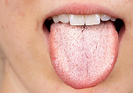 El doctor Alexandre Olmos explica cómo la lengua puede revelar un problema común de salud: «¿Notas algo extraño?»