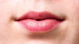 ¿Es el virus del herpes labial una causa desconocida de alzhéimer?