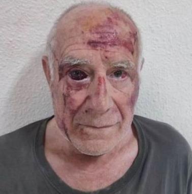 Imagen - Estado en el que quedó Domingo tras la paliza.