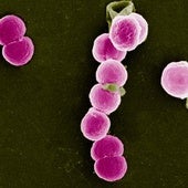 Imagen al microscopio de la bacteria que causa la infección, la Neisseria gonorrhoeae