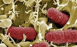 A Espanha não recomenda o uso de Augmentin para faringite devido ao “alto risco de resistência”.