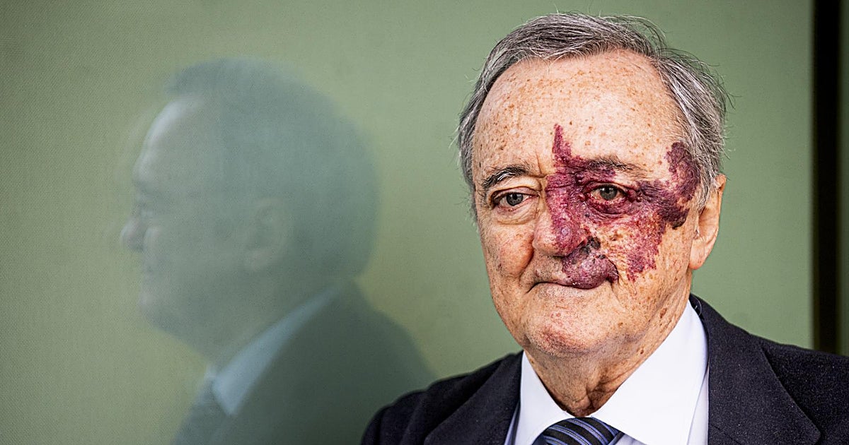 Barbacid renuncia a los posibles beneficios económicos de su investigación sobre el cáncer de páncreas