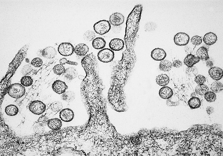 ¿Ha podido mutar el hantavirus?: «Sin la secuencia genómica, solo podemos especular»