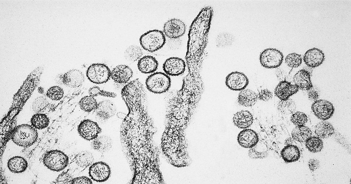 ¿Ha podido mutar el hantavirus?: «Sin la secuencia genómica, solo podemos especular»