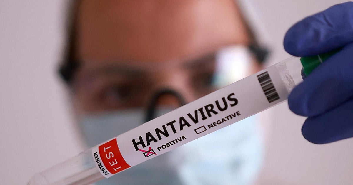 Hantavirus, un reto que España no puede suspender