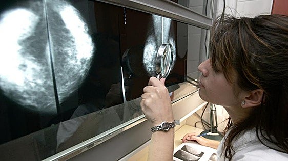 La OMS avisa de que el cáncer va camino de duplicar su incidencia en 2050