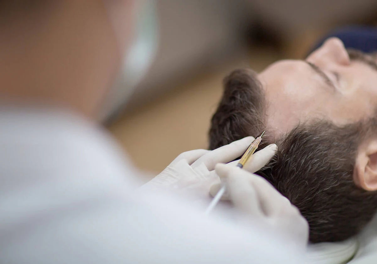 Bótox para frenar la caída del pelo, lo úlitimo contra la calvicie.