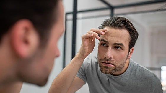 ¿Tener entradas es sinónimo de sufrir alopecia en el futuro?