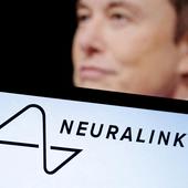 Elon Musk asegura que ha implantado su Neuralink en un ser humano
