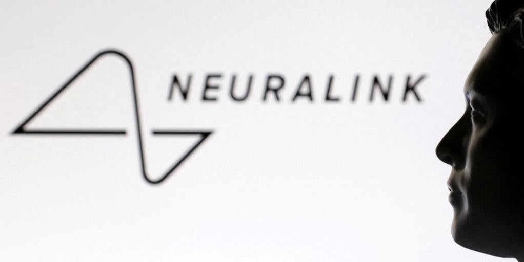 イーロン・マスク氏が Neuralink の 2 年間の進歩を発表