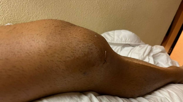 Rodilla inflamada del atleta onubense
