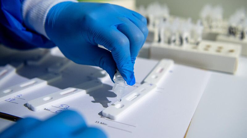 Huelva suma 861 positivos pero es la provincia andaluza con menos hospitalizados por Covid-19