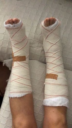 Una vecina del barrio Costa de la Luz sufre un accidente debido al mal estado de las infraestructuras