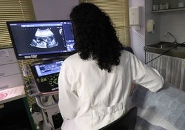 El Hospital Juan Ramón Jiménez incorpora nueve ecógrafos de alta precisión para mejorar el control del embarazo