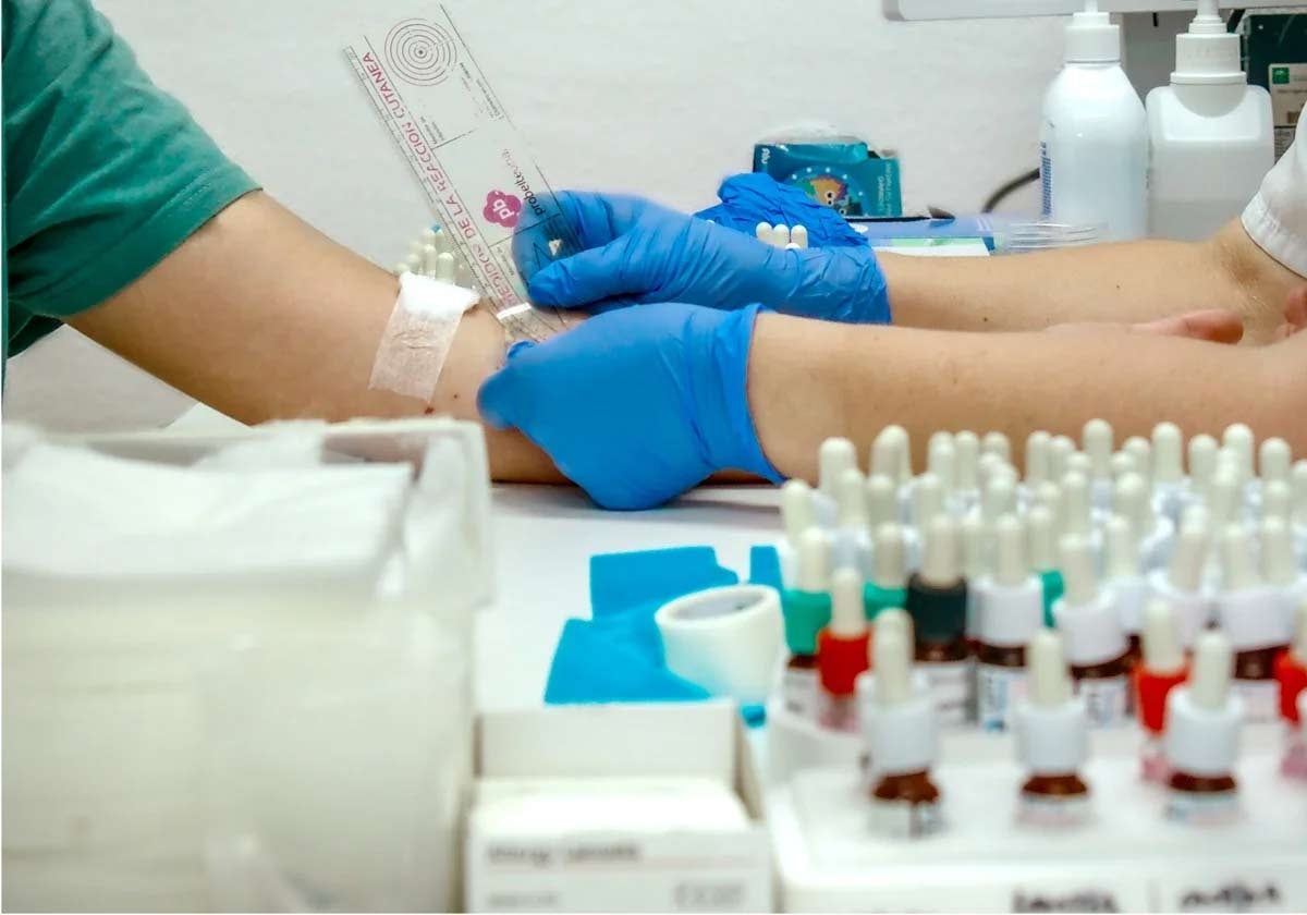 Consulta hospitalaria de alergología