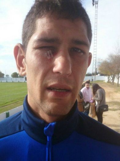 La Olímpica explota contra el árbitro y el Recreativo tras el codazo a Braulio