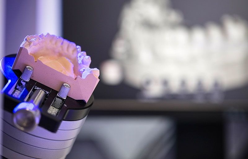 La revolución digital ya es una realidad consolidada en iDental