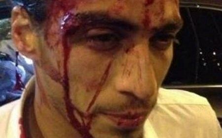 Martín Cáceres estará unos dos meses de baja