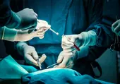 Condenan al SAS por dejarse el cirujano un trozo de pinza dentro tras una cirugía de hernia discal a una paciente
