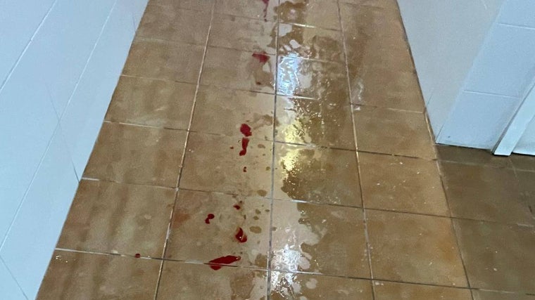 El menor sufrió una enorme e impactante herida.