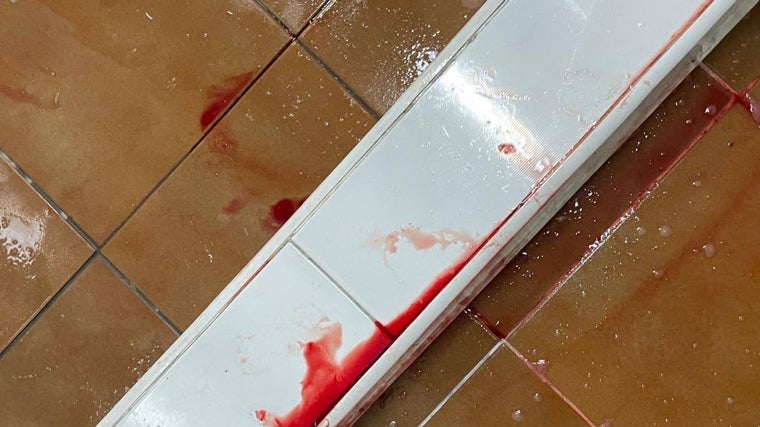Así quedó la zona después del accidente.