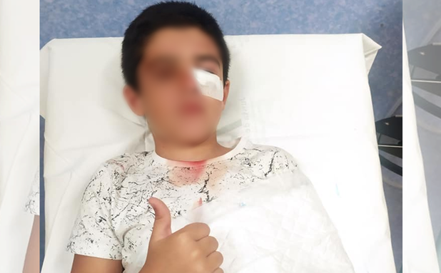 Un niño sufre un accidente en Jerez y su madre denuncia el deterioro de las instalaciones: «Mi hijo casi pierde el ojo»