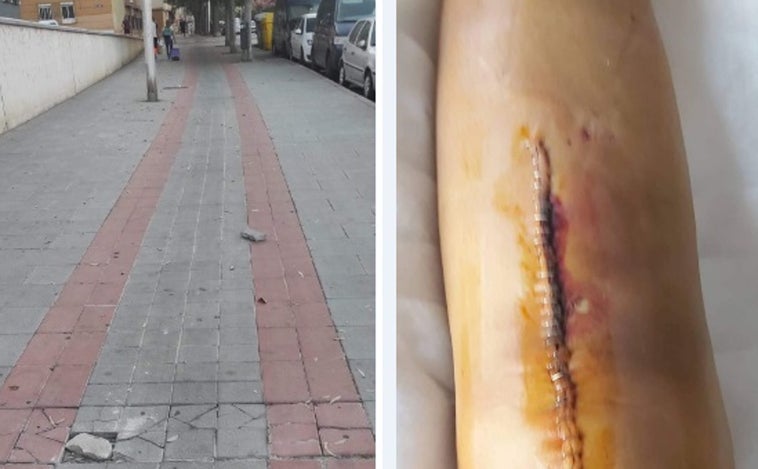 Denuncia que se rompe la tibia por el mal estado del carril bici de Cádiz